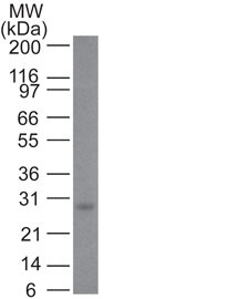 Western Blot: Human skin lysate, 10ug. Using Mouse monoclonal Bcl-2 [Clone 100/D5] antibody at 1:500.